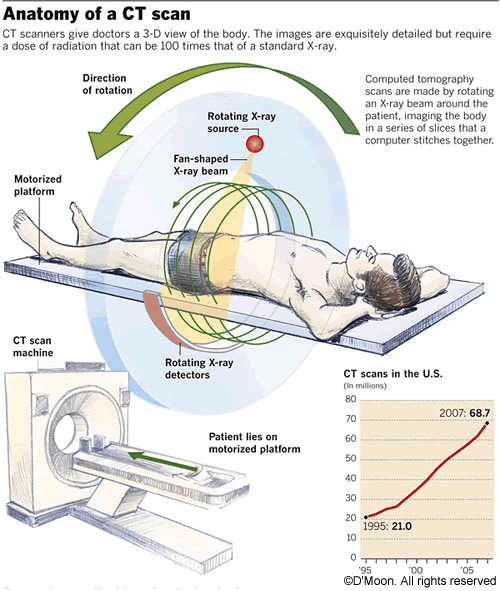 ultrasound scan diagram