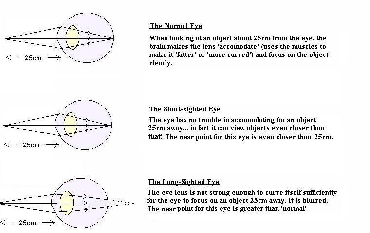 Cyberphysics - The human eye, sight defects and their correction