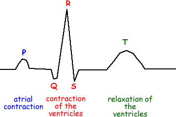 Pqrst Chart